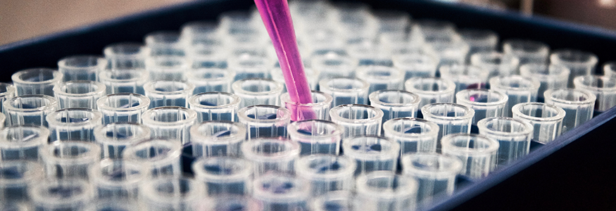 Close up of a pipette putting liquid into test tubes
